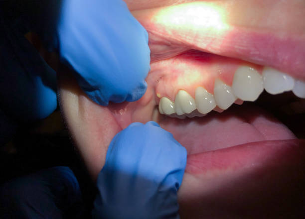 Professional Emergency Dental Service in MS
